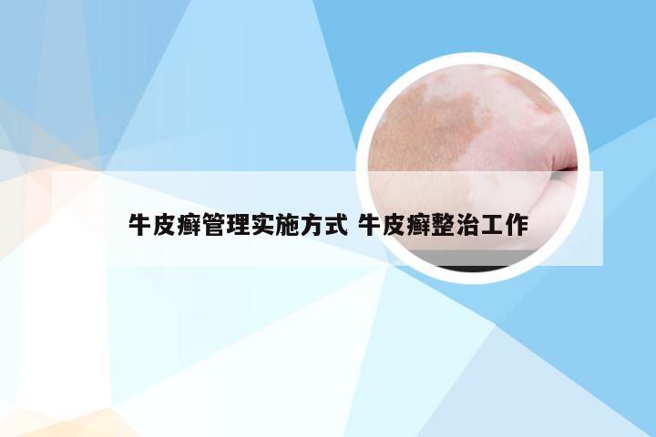 牛皮癣管理实施方式 牛皮癣整治工作
