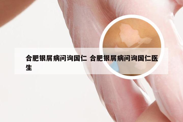 合肥银屑病问询国仁 合肥银屑病问询国仁医生