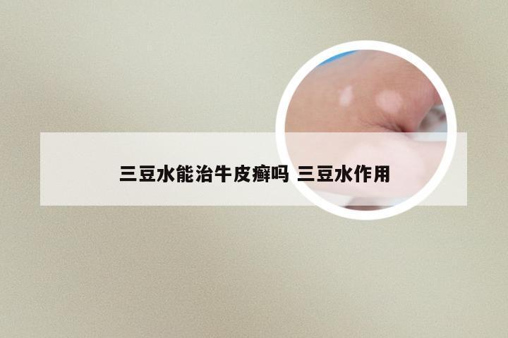 三豆水能治牛皮癣吗 三豆水作用
