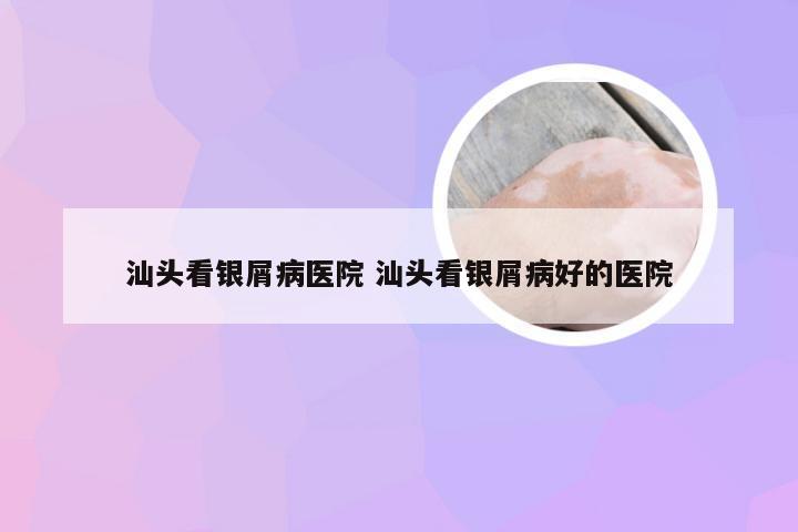 汕头看银屑病医院 汕头看银屑病好的医院