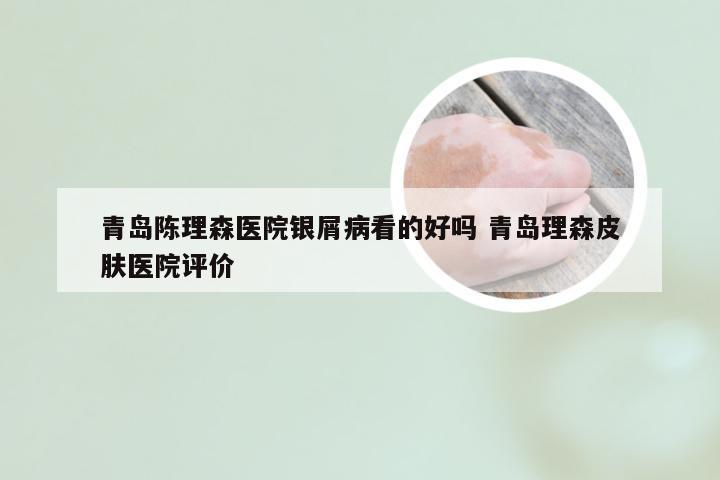 青岛陈理森医院银屑病看的好吗 青岛理森皮肤医院评价