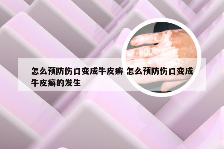 怎么预防伤口变成牛皮癣 怎么预防伤口变成牛皮癣的发生
