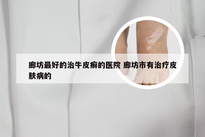 廊坊最好的治牛皮癣的医院 廊坊市有治疗皮肤病的