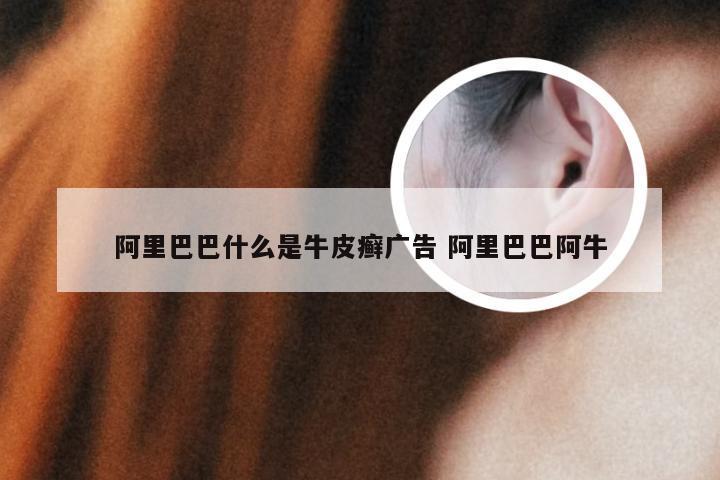 阿里巴巴什么是牛皮癣广告 阿里巴巴阿牛