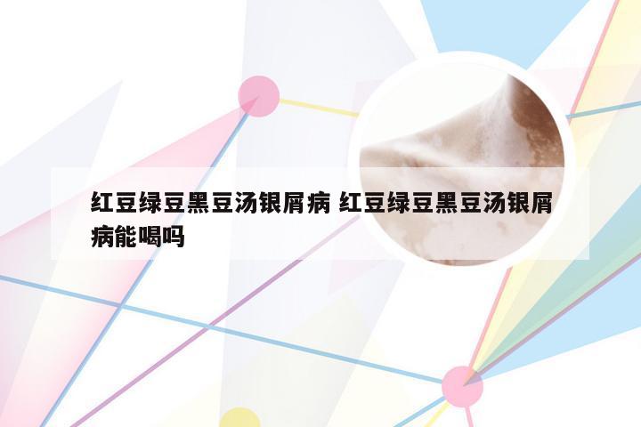 红豆绿豆黑豆汤银屑病 红豆绿豆黑豆汤银屑病能喝吗