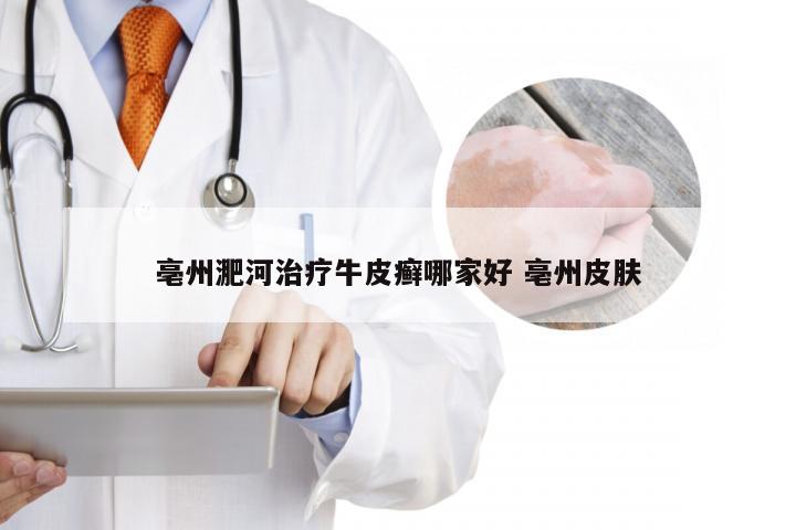 亳州淝河治疗牛皮癣哪家好 亳州皮肤
