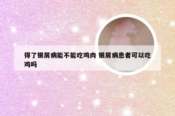 得了银屑病能不能吃鸡肉 银屑病患者可以吃鸡吗