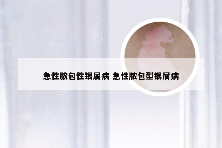 急性脓包性银屑病 急性脓包型银屑病