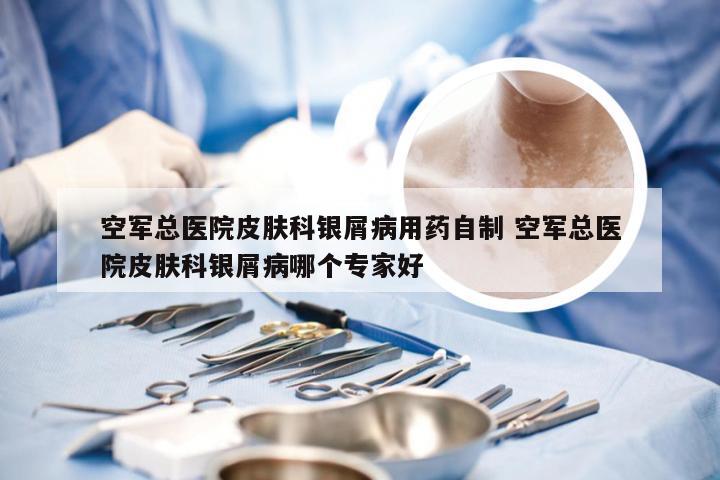 空军总医院皮肤科银屑病用药自制 空军总医院皮肤科银屑病哪个专家好