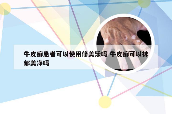 牛皮癣患者可以使用修美乐吗 牛皮癣可以抹郁美净吗