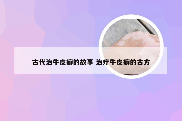 古代治牛皮癣的故事 治疗牛皮癣的古方