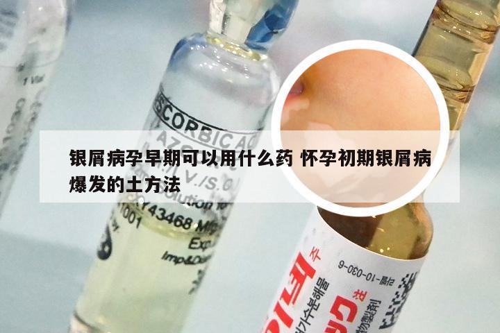 银屑病孕早期可以用什么药 怀孕初期银屑病爆发的土方法