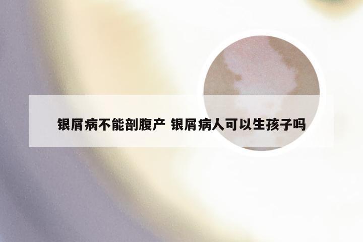 银屑病不能剖腹产 银屑病人可以生孩子吗