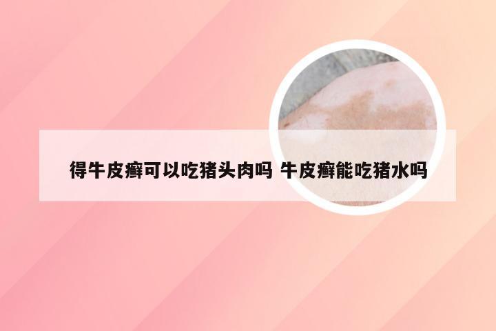 得牛皮癣可以吃猪头肉吗 牛皮癣能吃猪水吗