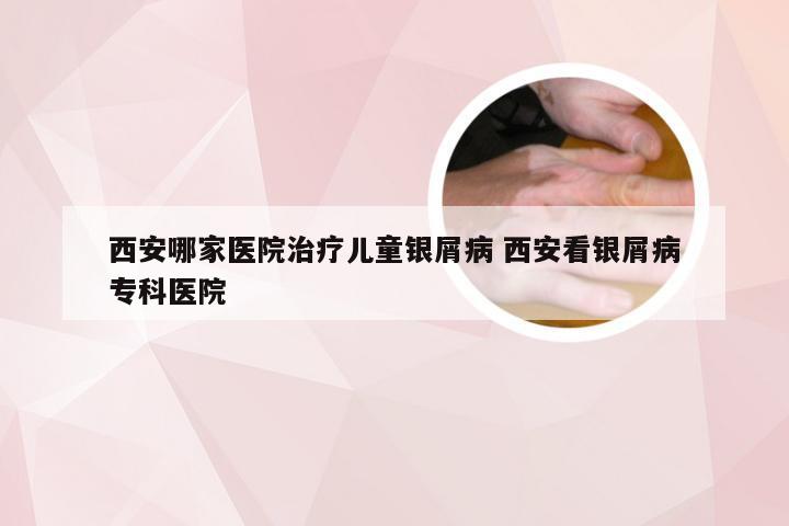西安哪家医院治疗儿童银屑病 西安看银屑病专科医院