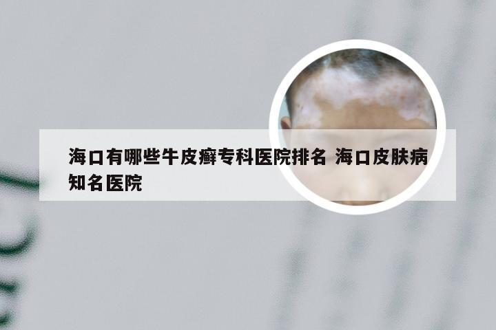 海口有哪些牛皮癣专科医院排名 海口皮肤病知名医院