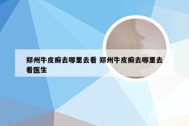 郑州牛皮癣去哪里去看 郑州牛皮癣去哪里去看医生