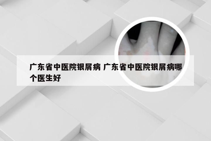 广东省中医院银屑病 广东省中医院银屑病哪个医生好