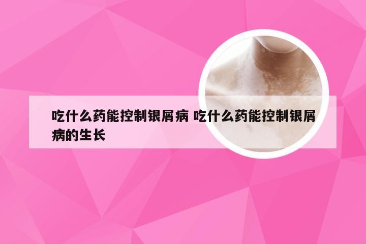吃什么药能控制银屑病 吃什么药能控制银屑病的生长
