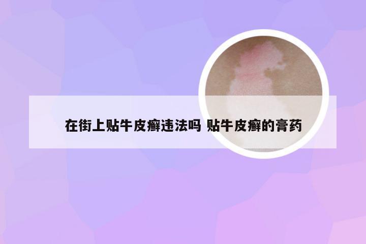在街上贴牛皮癣违法吗 贴牛皮癣的膏药