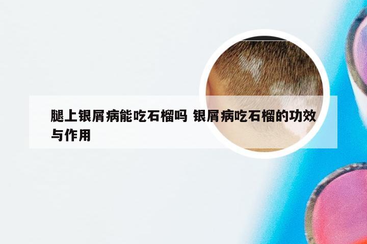 腿上银屑病能吃石榴吗 银屑病吃石榴的功效与作用