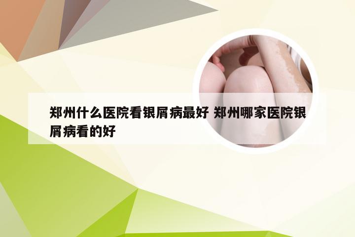 郑州什么医院看银屑病最好 郑州哪家医院银屑病看的好