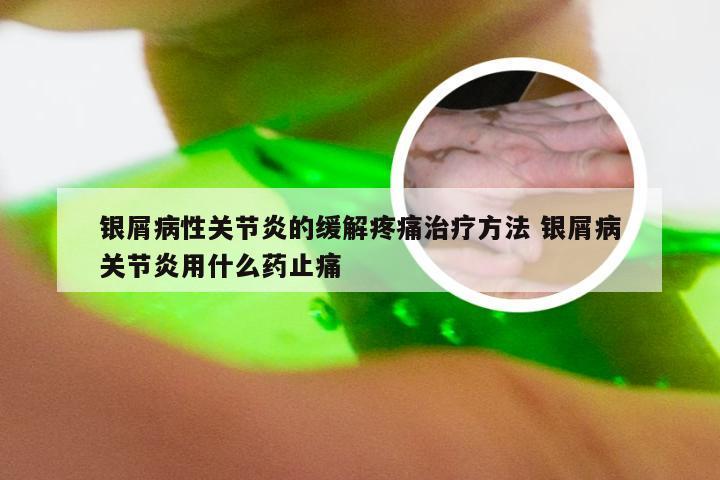 银屑病性关节炎的缓解疼痛治疗方法 银屑病关节炎用什么药止痛
