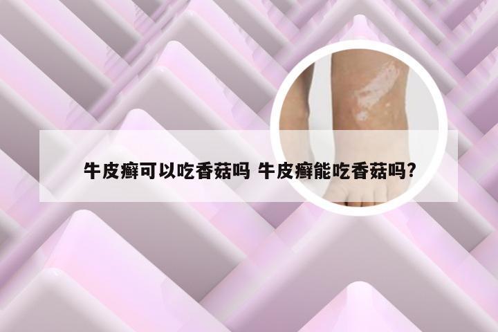 牛皮癣可以吃香菇吗 牛皮癣能吃香菇吗?