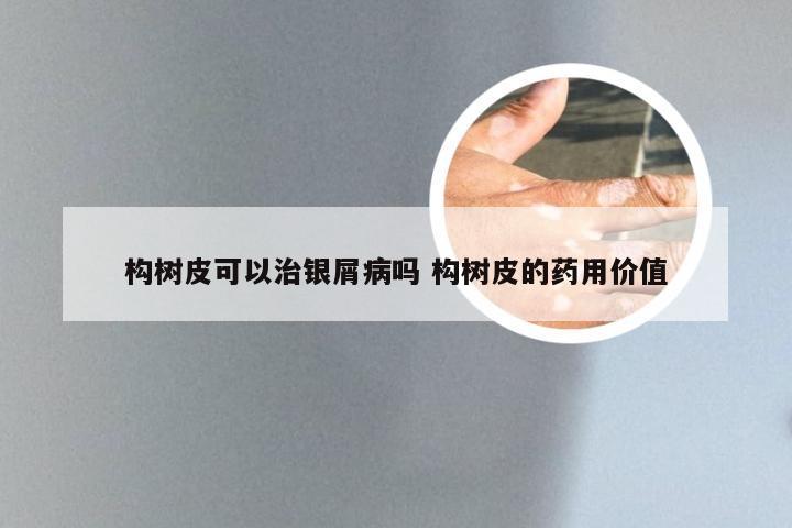 构树皮可以治银屑病吗 构树皮的药用价值