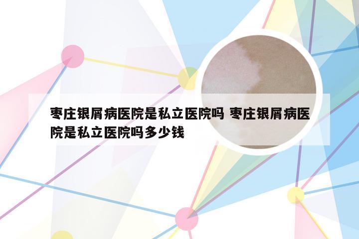 枣庄银屑病医院是私立医院吗 枣庄银屑病医院是私立医院吗多少钱