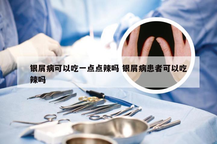 银屑病可以吃一点点辣吗 银屑病患者可以吃辣吗