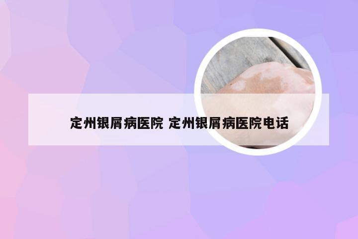 定州银屑病医院 定州银屑病医院电话