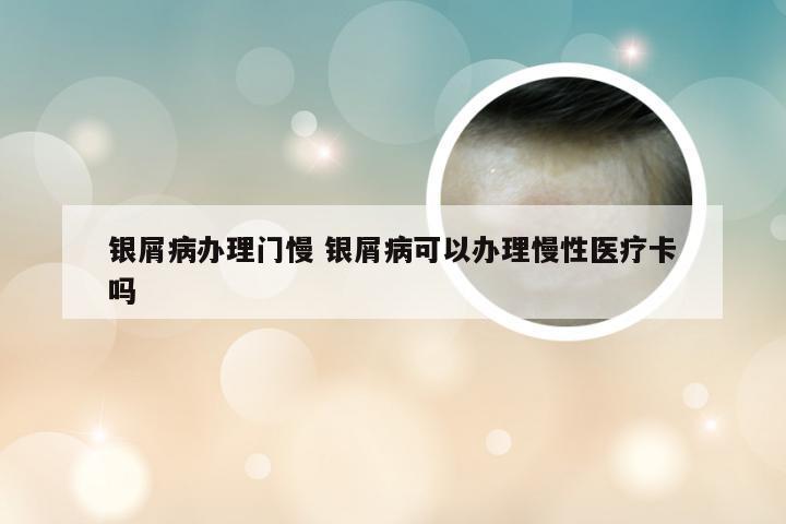 银屑病办理门慢 银屑病可以办理慢性医疗卡吗
