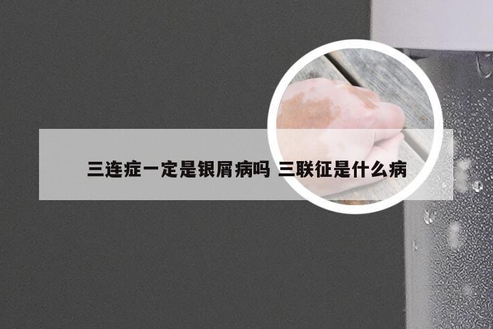 三连症一定是银屑病吗 三联征是什么病