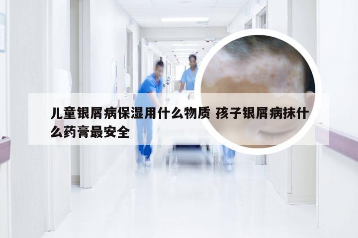 儿童银屑病保湿用什么物质 孩子银屑病抹什么药膏最安全