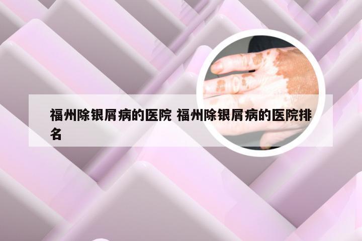 福州除银屑病的医院 福州除银屑病的医院排名