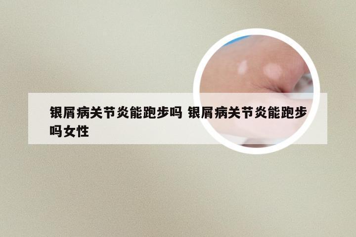 银屑病关节炎能跑步吗 银屑病关节炎能跑步吗女性