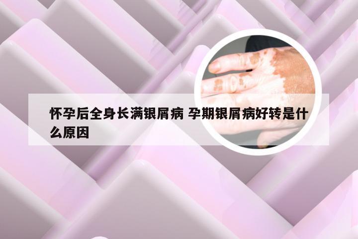 怀孕后全身长满银屑病 孕期银屑病好转是什么原因