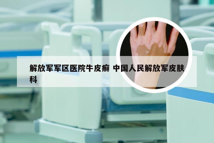 解放军军区医院牛皮癣 中国人民解放军皮肤科