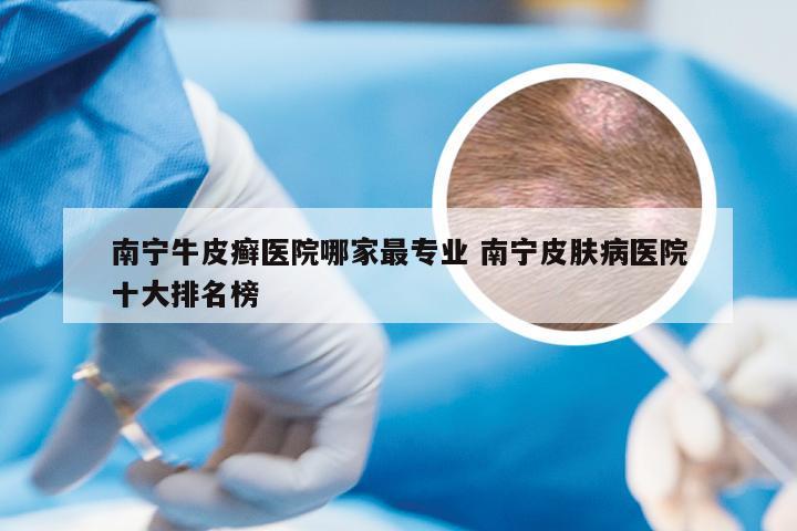 南宁牛皮癣医院哪家最专业 南宁皮肤病医院十大排名榜