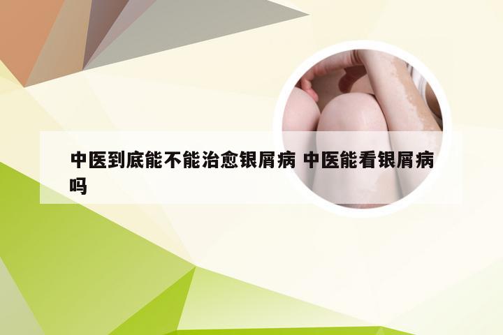 中医到底能不能治愈银屑病 中医能看银屑病吗