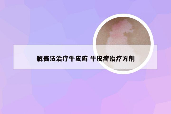 解表法治疗牛皮癣 牛皮癣治疗方剂