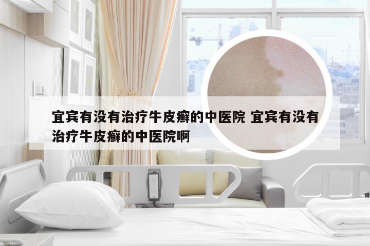宜宾有没有治疗牛皮癣的中医院 宜宾有没有治疗牛皮癣的中医院啊