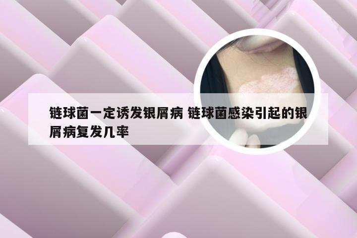 链球菌一定诱发银屑病 链球菌感染引起的银屑病复发几率