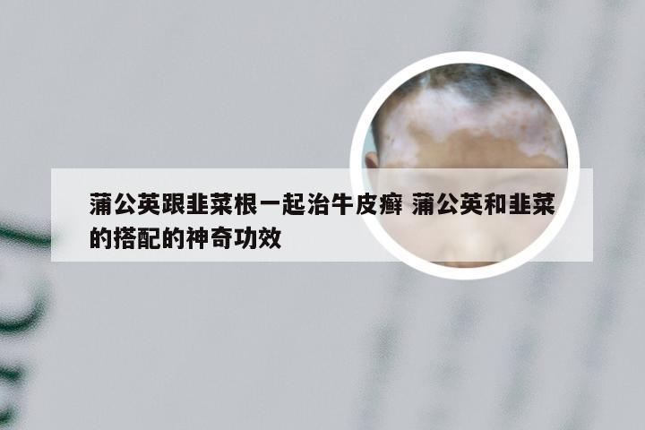 蒲公英跟韭菜根一起治牛皮癣 蒲公英和韭菜的搭配的神奇功效