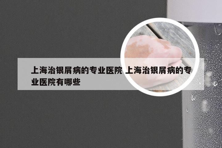 上海治银屑病的专业医院 上海治银屑病的专业医院有哪些