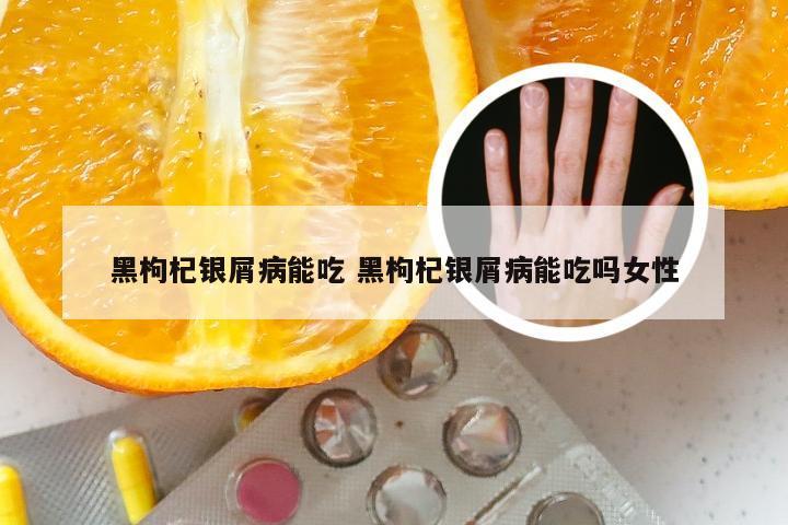 黑枸杞银屑病能吃 黑枸杞银屑病能吃吗女性