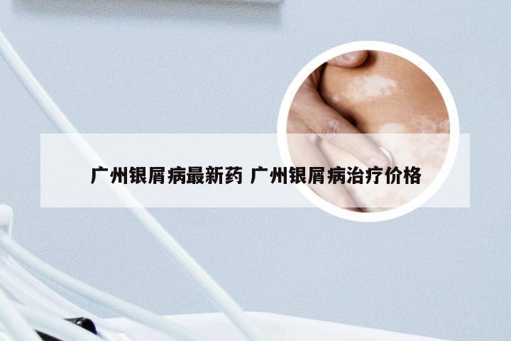 广州银屑病最新药 广州银屑病治疗价格