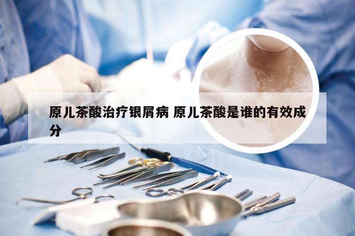 原儿茶酸治疗银屑病 原儿茶酸是谁的有效成分