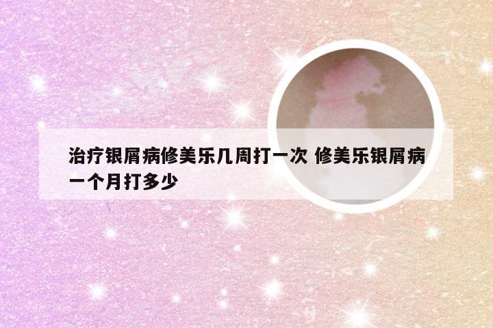 治疗银屑病修美乐几周打一次 修美乐银屑病一个月打多少